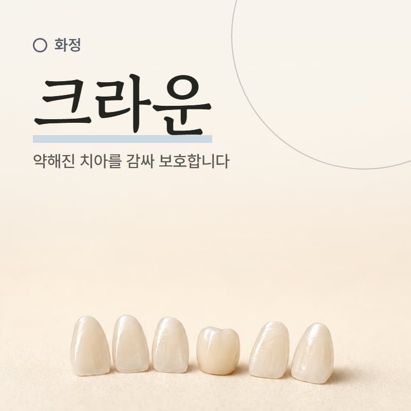구강스캐너 화면에 띄운 치아 본뜬 영상