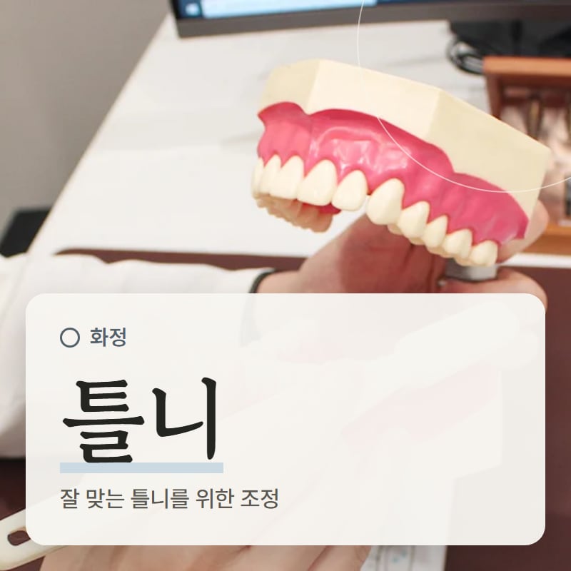 치아 모형으로 틀니와 잇몸 관리를 설명하는 장면
