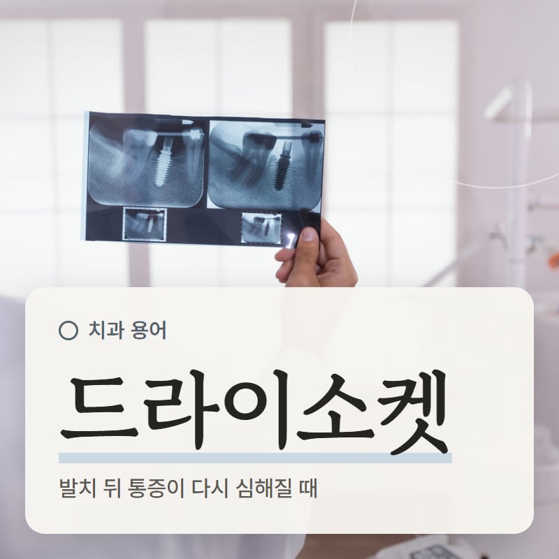 엑스레이 필름을 확인하는 의료진