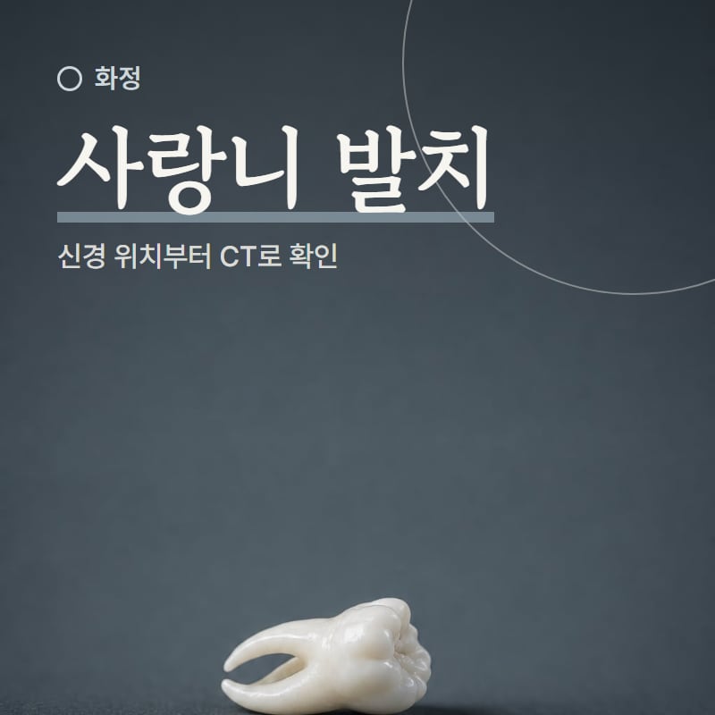 사랑니 발치를 진행하는 진료 장면